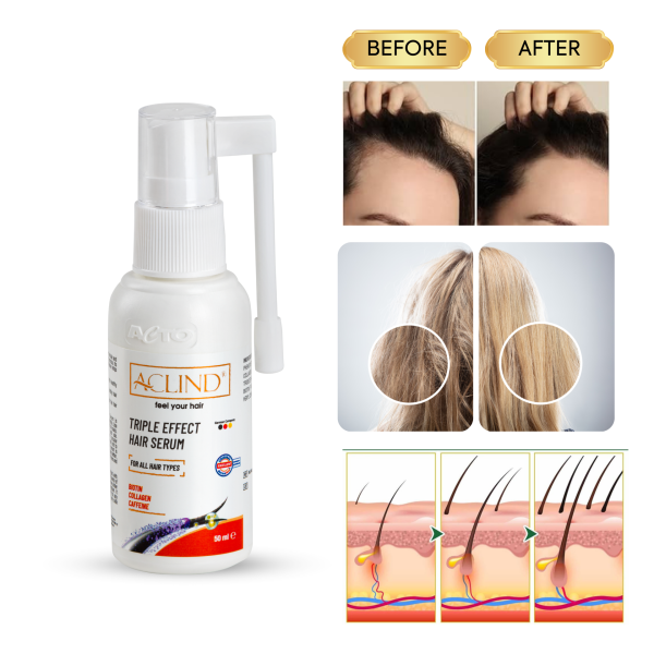 ACLIND® TRIPLE EFFECT SERUM Saç Dökülmesine Karşı Saç Serum 50 ml