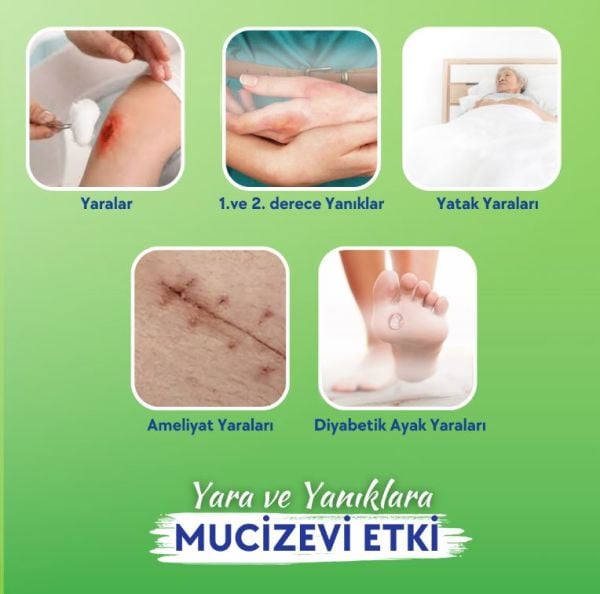ACTOLIND® w SOLUTION Monodose 10 x 5 ml [Yara İyileştirme Solüsyonu] - Toptan Satış