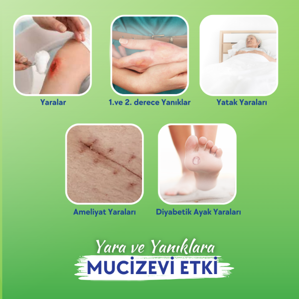 Actolind ® w GEL Monodose 10 x 5 ml | Yara İyileştirme Jeli - Toptan Satış