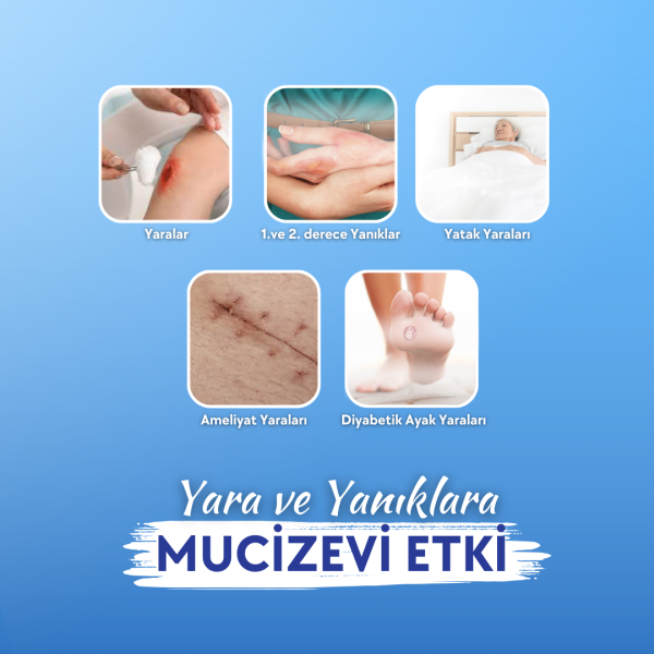 Actolind ® Gel Plus | Yara Bakım Jeli - Toptan Satış