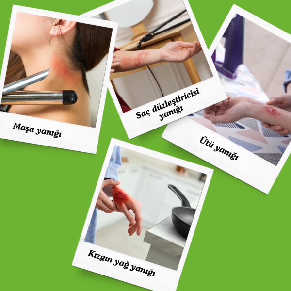 Actolind ® w GEL Monodose 10 x 5 ml | Yara İyileştirme Jeli