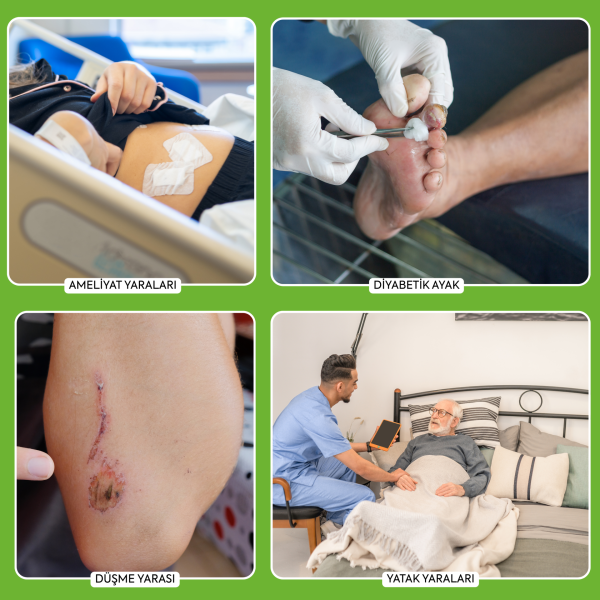 Actolind ® w GEL Monodose 10 x 5 ml | Yara İyileştirme Jeli