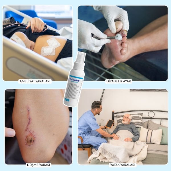 Actolind ® Solution Plus 100 ml | Yara Bakım Solüsyonu