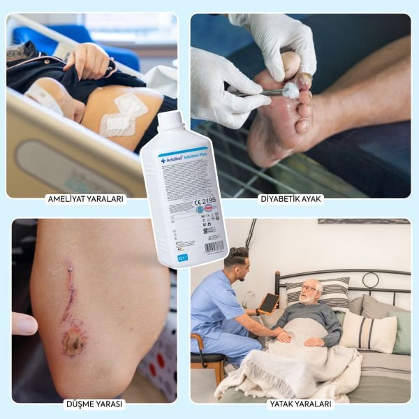 Actolind ® Solution Plus 1 L | Yara Bakım Solüsyonu