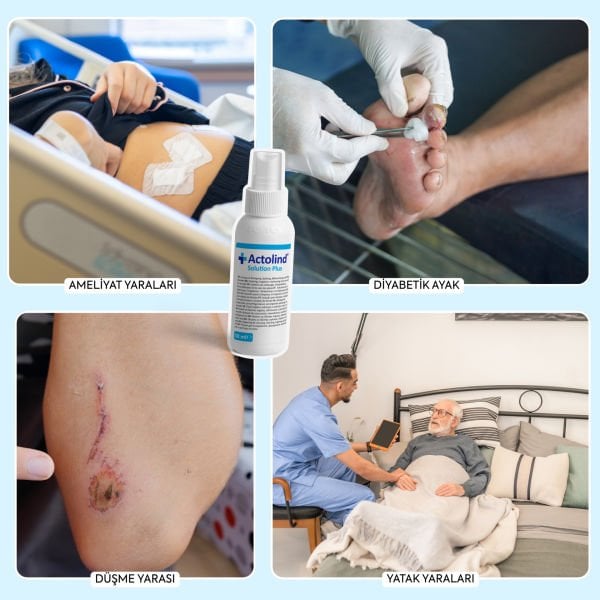 Actolind ® Solution Plus 50 ml | Yara Bakım Solüsyonu