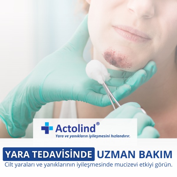 Actolind ® Solution Plus 500 ml | Yara Bakım Solüsyonu