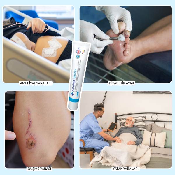 Actolind ® Gel Plus 30 ml | Yara Bakım Jeli