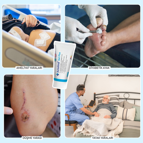 Actolind ® Gel Plus 10 ml | Yara Bakım Jeli