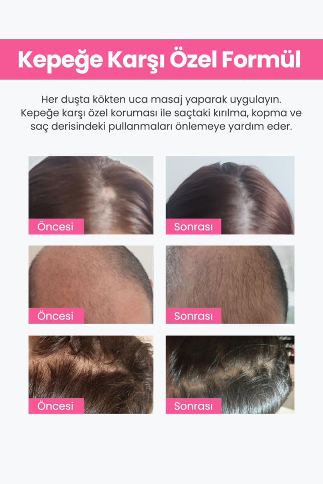 Keratin 3'lü Saç Seti + 3'Lü Şampuan + 3'Lü Maske