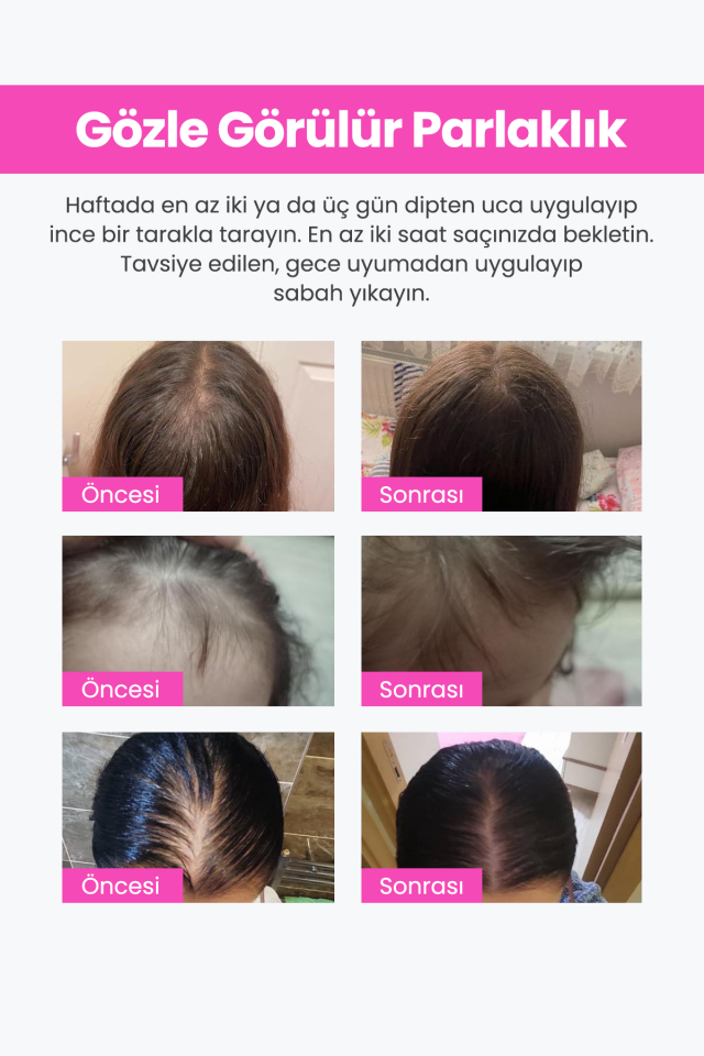 La Vesa 3 Lü Şampuan  +  3 Lü Saç Maskesi  + 3Lü Keratin Saç Spreyi