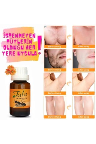 Tala Karınca Yumurtası Yağı Tüy Dökücü Tüy Azaltıcı Tüy İnceltici 20 Ml