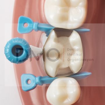 Dentsply CIRCUMFERENTIAL MATRIX SYSTEM Palodent 360