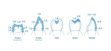 Celtra Duo C14 Cerec Cad-Cam Blok 4'lü