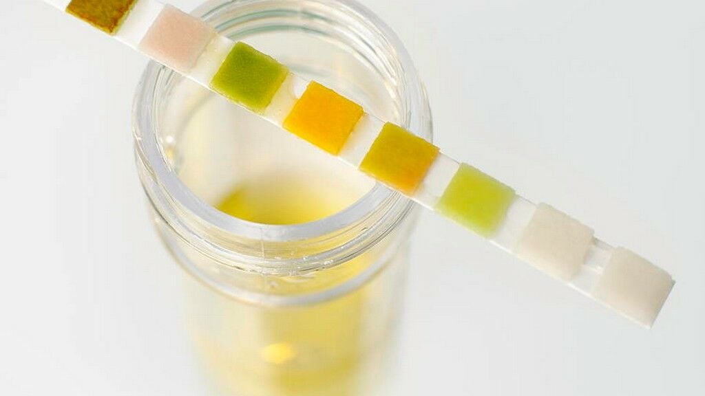 İdrar Stribi: Hızlı, Pratik ve Güvenilir Bir Tanı Aracı