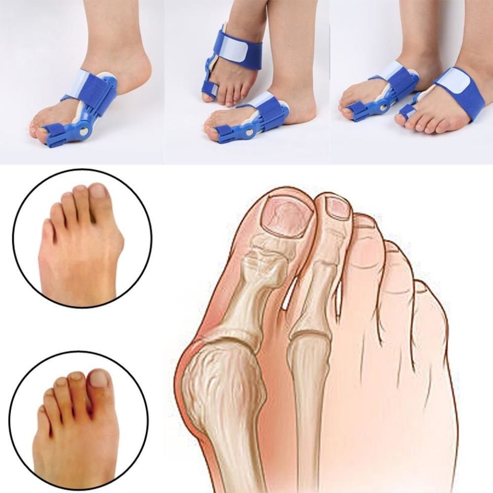 Yeni Nesil Hallux Valgus Ateli Bedensiz