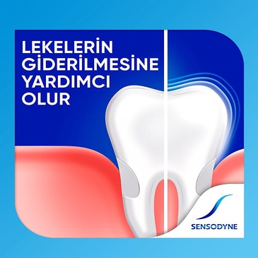 Sensodyne F Diş Macunu 100ML - (SKT: 01/2027)