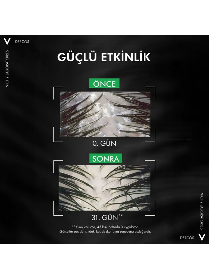 Vichy Dercos Kepek Karşıtı Şampuan Normal ve Yağlı Saçlar İçin 390ML