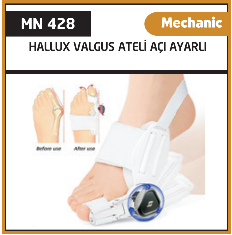 Minion Açı Ayarlı Mekanik Halluks Valgus Ateli