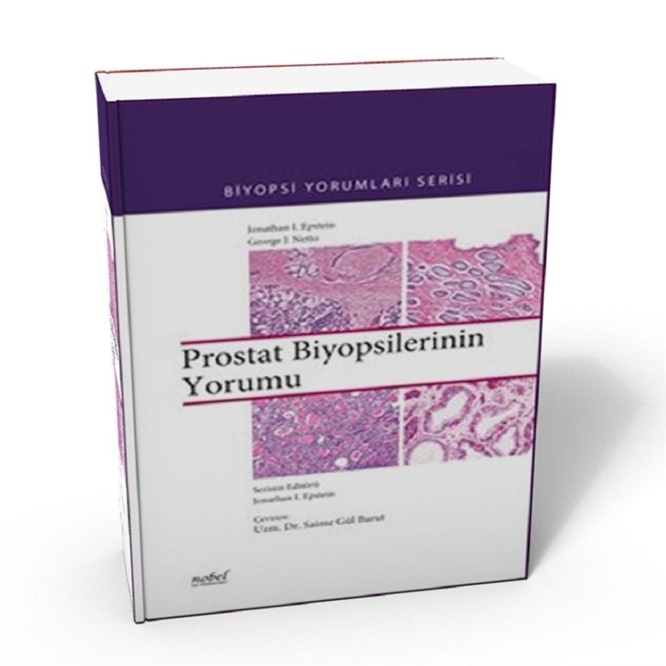 Prostat Biyopsilerinin Yorumu - Biyopsi Yorumları Serisi