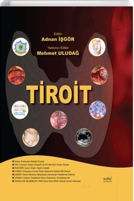 Tiroit
