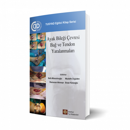 Ayak Bileği Çevresi Bağ ve Tendon Yaralanmaları