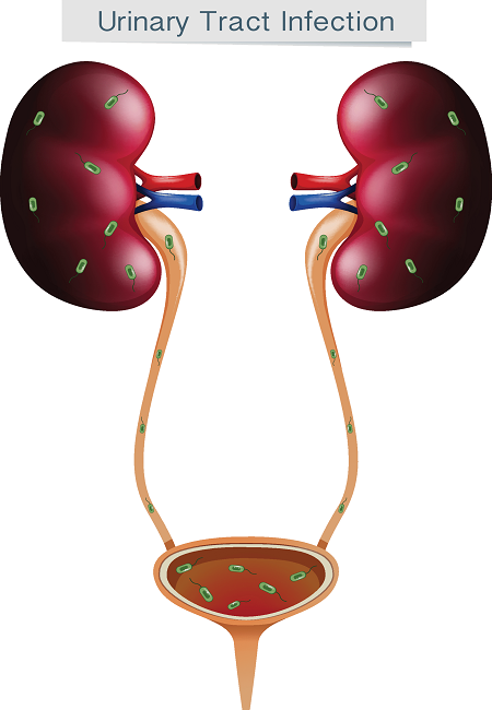 CKD KİT