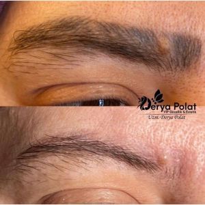 1 Adet Kalıcı Makyaj Silme Solüsyonu 10 ml