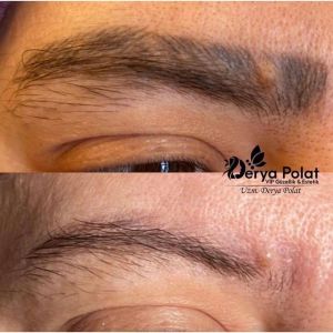 1 Adet Kalıcı Makyaj Silme Solüsyonu 6 ml