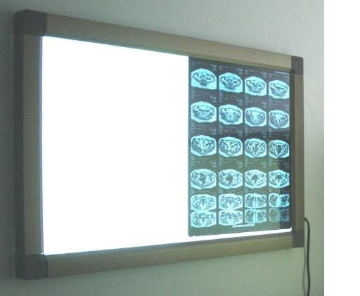 LCD Negatoskop Çiftli