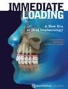 Immediate Loading: A New Era in Oral Implantology