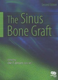 The Sinus Bone Graft