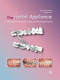 The Herbst Appliance Research Based Clinical Management