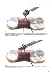 DİŞ HEKİMLERİ İÇİN CERRAHİ DİKİŞ SANATI KLİNİK REHBERİ - III