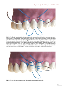 DİŞ HEKİMLERİ İÇİN CERRAHİ DİKİŞ SANATI KLİNİK REHBERİ - III