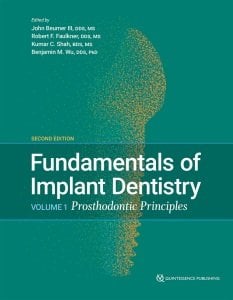 Fundamentals of Implant Dentistry