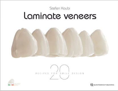 Laminate Veneers