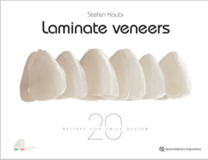Laminate Veneers