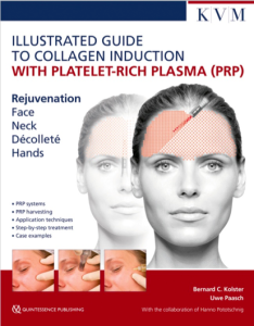 Illustrated Guide to Collagen Induction with Platelet-Rich Plasma (PRP)