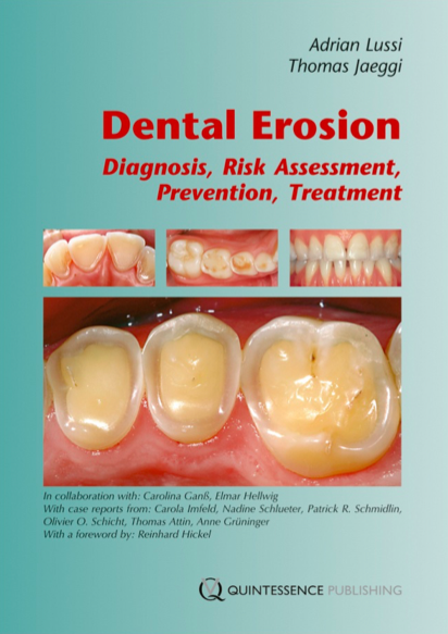 Dental Erosion