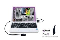 Myray Zen-x Size 1 RVG Cihazı