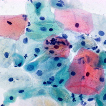 Merck 106888 Papanicolaou Çözeltisi 2A Orange G Çözeltisi (Og 6) Cytoplasm Staining Of Mature And Keratinized Cells İn Cytology  500 ml