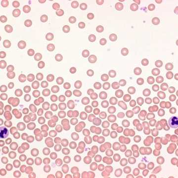 Merck 111661 Hemacolor® Rapid staining of blood smear staining set for microscopy