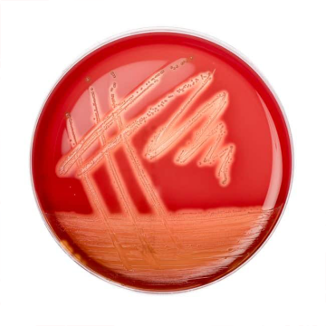 Across Bio 530480B Muller Kaufmann Broth Base with brilliant Green and Novobionic 500 gr