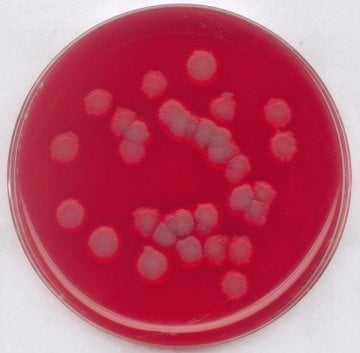 Merck 110886 Blood Agar (Base) For The İsolation And Cultivation Of Various Fastidious Microorganisms  500 gr