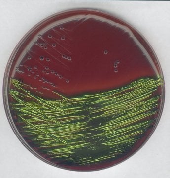Merck 101347 Emb Agar For The Detection And İsolation Of Pathogenic Enterobacteriaceae  500 gr