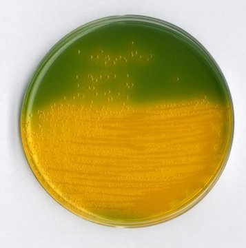 Merck 110263 Tcbs Agar For The İsolation And Selective Cultivation Of Vibrio Cholera  500 gr