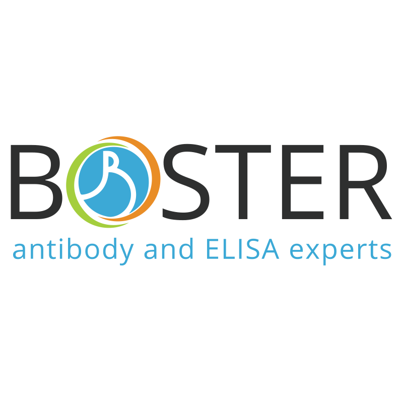 BOSTER A00102-2 Anti-IL6 Antibody Picoband™ 100 μg/vial