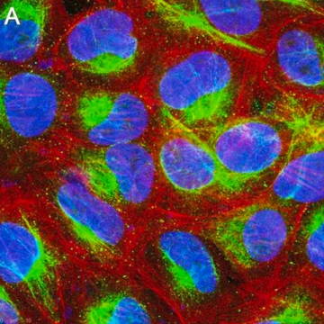 Sigma-Aldrich ZRB1681 Anti-Calreticulin Antibody, clone 1F16 ZooMAb® Rabbit Monoclonal recombinant, expressed in HEK 293 cells 25 µL