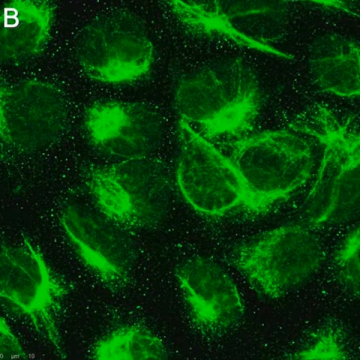 Sigma-Aldrich ZRB1681 Anti-Calreticulin Antibody, clone 1F16 ZooMAb® Rabbit Monoclonal recombinant, expressed in HEK 293 cells 25 µL