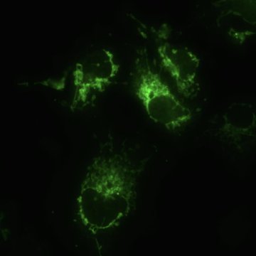 OPTIKA B-293PLi Trinoküler Araştırma Mikroskobu / IOS Optik Sistem